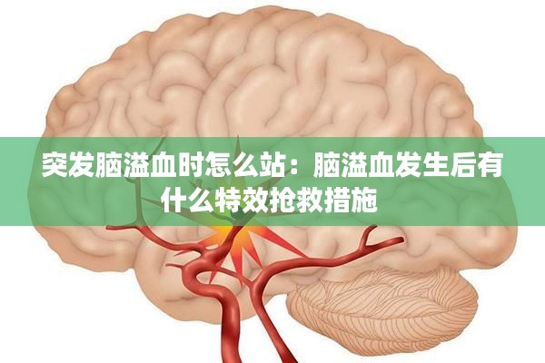 突发脑溢血时怎么站：脑溢血发生后有什么特效抢救措施 