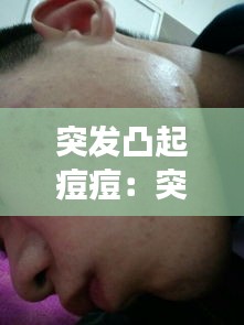 突发凸起痘痘：突然起了痘痘很硬,怎么快速消下去 