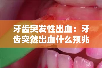 牙齿突发性出血：牙齿突然出血什么预兆 