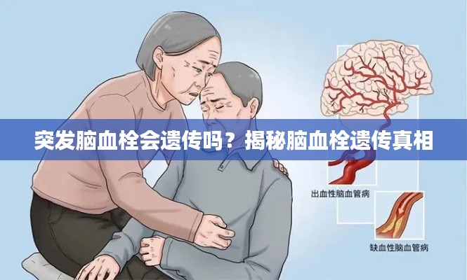 突发脑血栓会遗传吗？揭秘脑血栓遗传真相