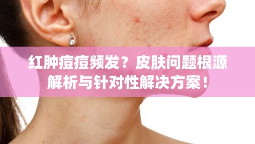 红肿痘痘频发？皮肤问题根源解析与针对性解决方案！