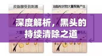 深度解析，黑头的持续清除之道