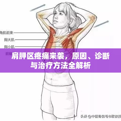 肩胛区疼痛来袭，原因、诊断与治疗方法全解析