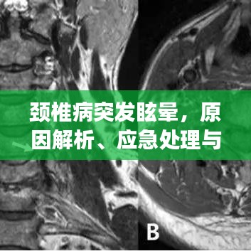 颈椎病突发眩晕，原因解析、应急处理与预防策略