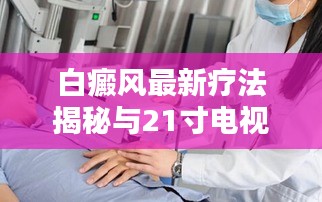 白癜风最新疗法揭秘与21寸电视价格详述
