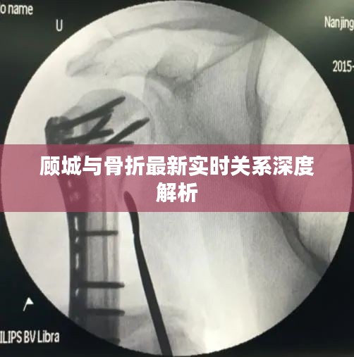 顾城与骨折最新实时关系深度解析