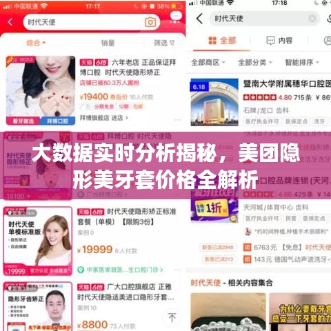 大数据实时分析揭秘，美团隐形美牙套价格全解析