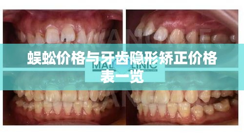 蜈蚣价格与牙齿隐形矫正价格表一览
