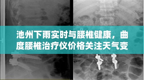 池州下雨实时与腰椎健康，曲度腰椎治疗仪价格关注天气变化与健康并行