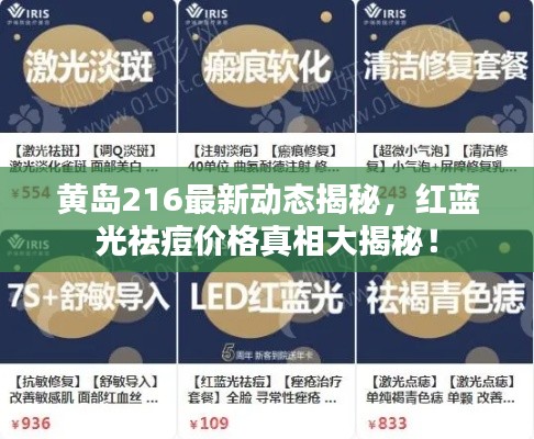 黄岛216最新动态揭秘,红蓝光祛痘价格真相大揭秘!