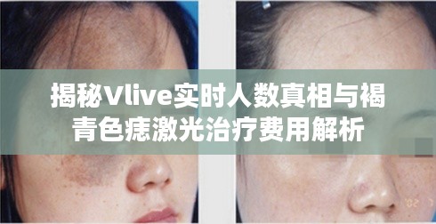 揭秘Vlive实时人数真相与褐青色痣激光治疗费用解析